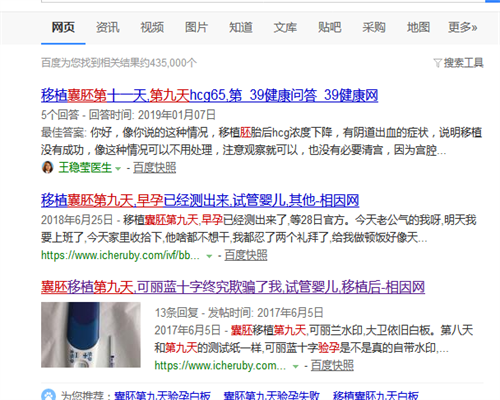精索静脉曲张不育