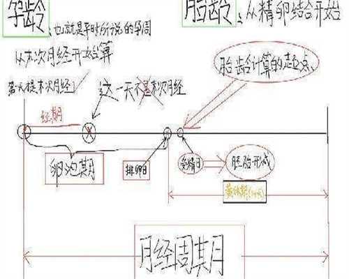 PCOS不孕